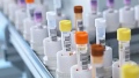 Harmonizacija akreditacije prema ISO 15189 - Hujsman/Telen
