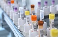 Harmonizacija akreditacije prema ISO 15189 - Hujsman/Telen